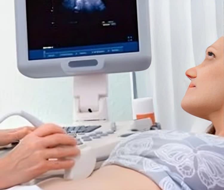 Gynecological ultrasound equipment